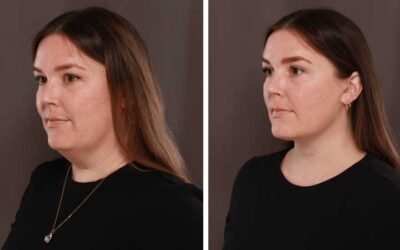The Surprising Ways Jaw Health Affects Your Facial Aesthetics and Fitness